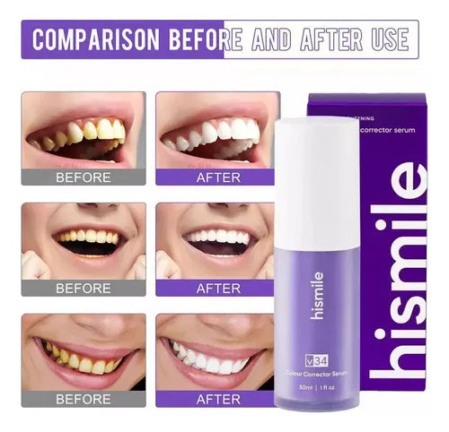 HISMILE® - PASTA DENTAL BLANQUEADOR